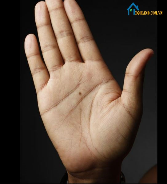 Nốt ruồi trong lòng bàn tay phải ở nam mang ý nghĩa gì?